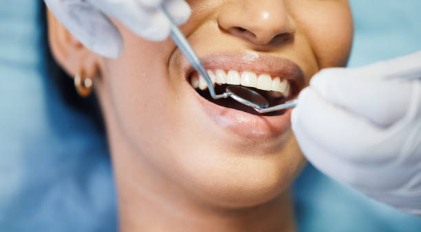 Best Knocked-Out Tooth Emergency  in West Orange, TX